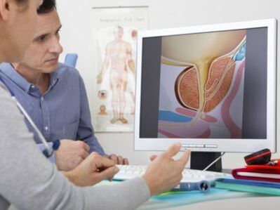 A urologist advises a patient about potency problems